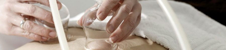 Schröpfgläser auf dem Rücken einer Patientin